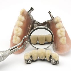 Denture Repairs