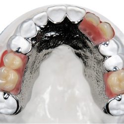 CHROME DENTURES PENRITH